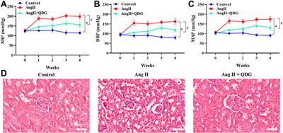 Qingda Granule Attenuates Angiotensin II-Induced Renal Apoptosis and Activation of the p53 Pathway